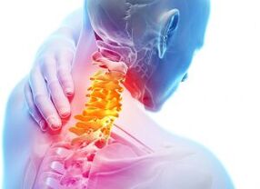 Durere și adăposturi în zona cervicală cu al treilea grad de osteochondroză