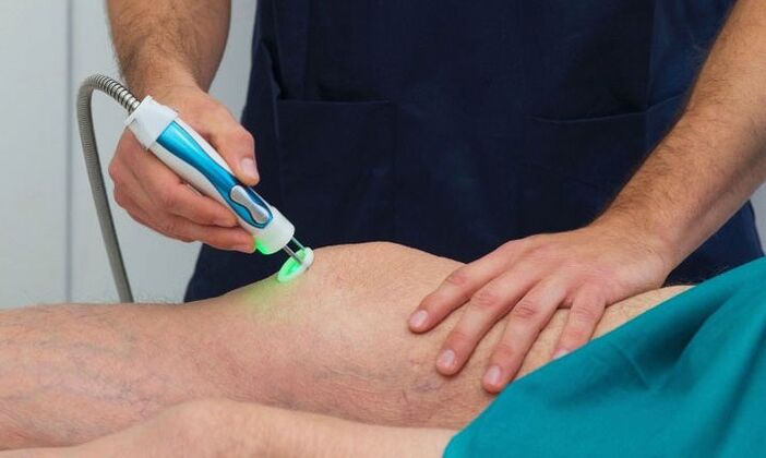 termografia articulației genunchiului cu artroză